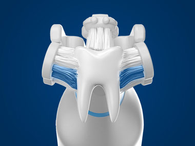 tooth-with-brush-heads-in-action